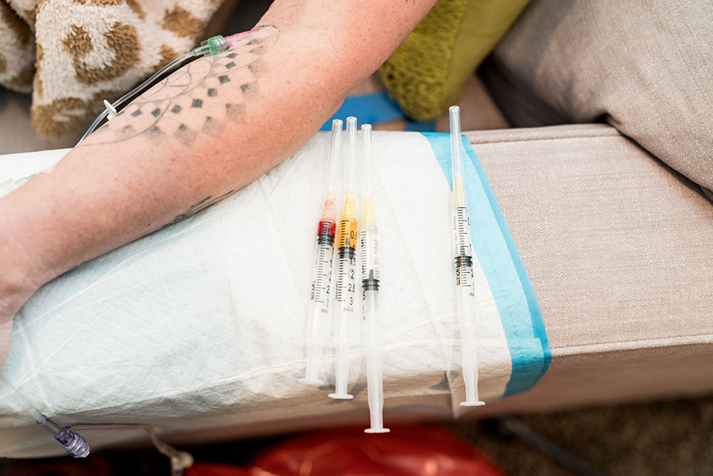 IV for sickness being administered. Close up of 4 syringes loaded with vitamins