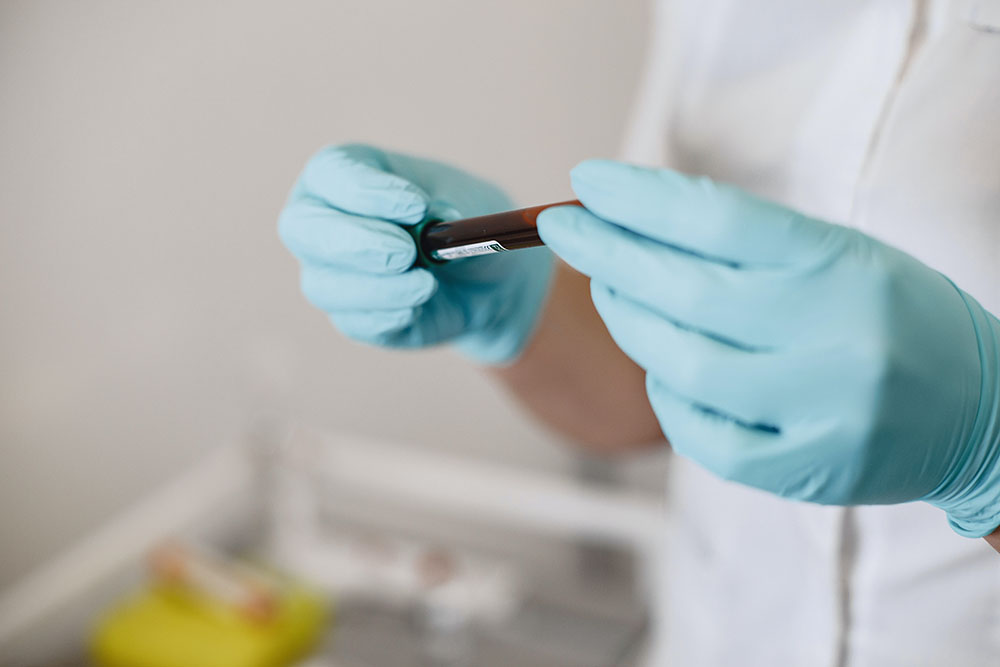 Anemia home test being processed by a technician. The blood vial is being held in two gloved hands